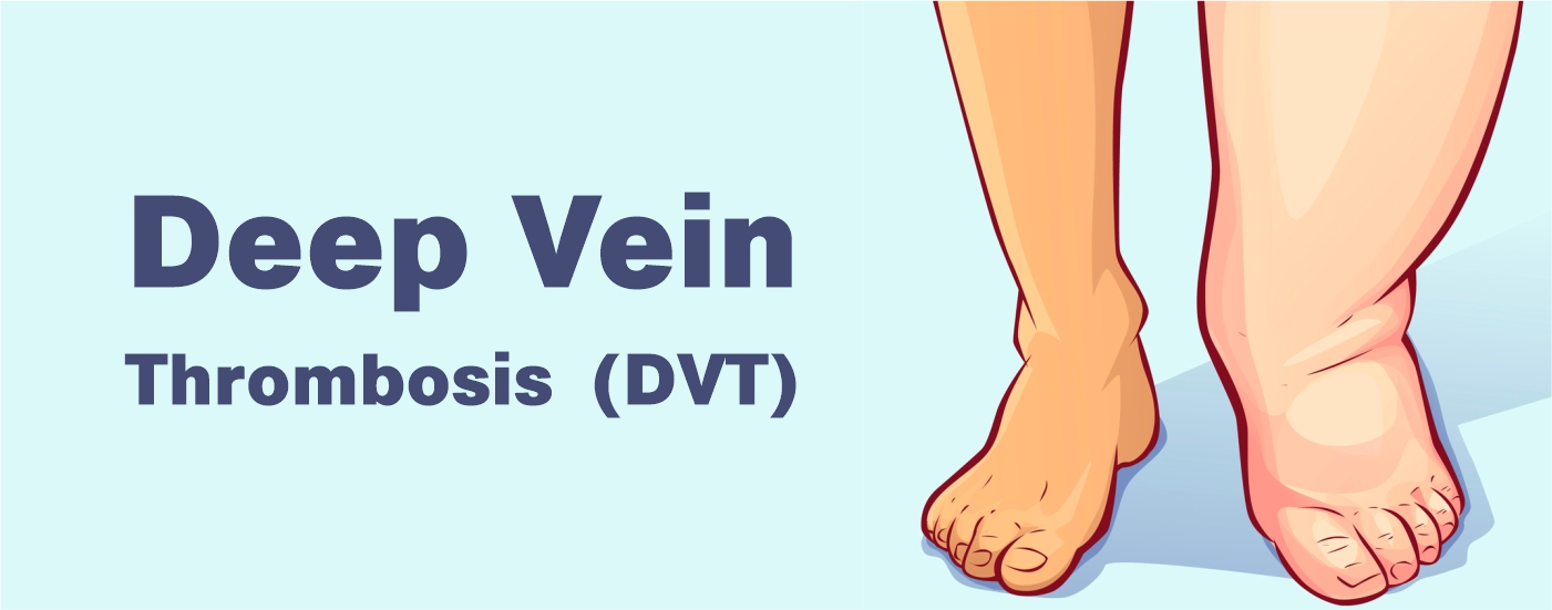 Best varicose veins treatment-Jaju Clinic